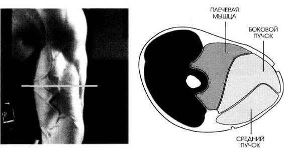 MR-1 разрез работы двуглавой мышцы при сгибании рук со штангой стоя с изогнутым грифом и подвесным упором