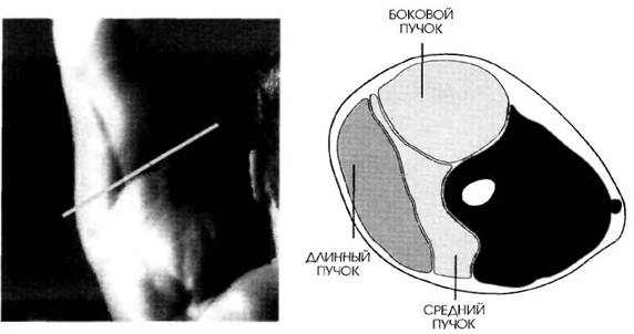 MR-1 разрез работы мышц трицепса при французском жиме стоя с прямым грифом
